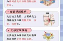 颈椎病预防方法/颈椎病预防办法